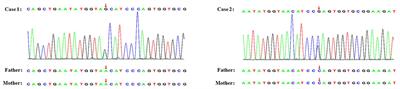 Two Children With Novel TRPC6 Spontaneous Missense Mutations and Atypical Phenotype: A Case Report and Literature Review